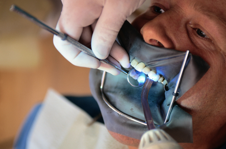 Tooth Cleaning with Dental Dam
